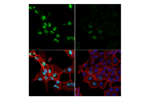 Immunofluorescence Image 1: NCoR1 (E4S4N) Rabbit mAb