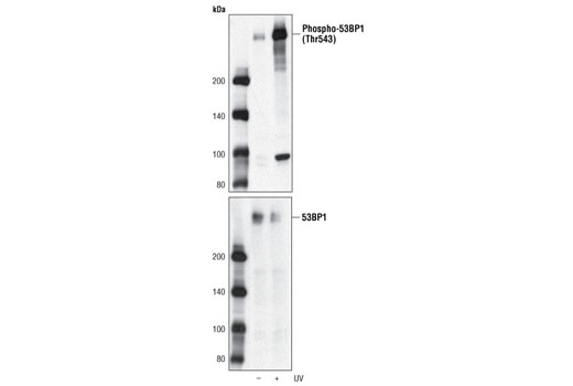 Western Blotting Image 1: Phospho-53BP1 (Thr543) Antibody