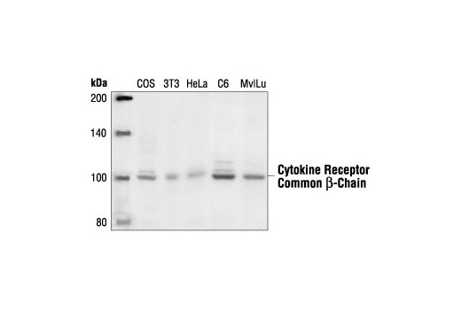Western Blotting Image 1: Cytokine Receptor Common beta-Chain Antibody