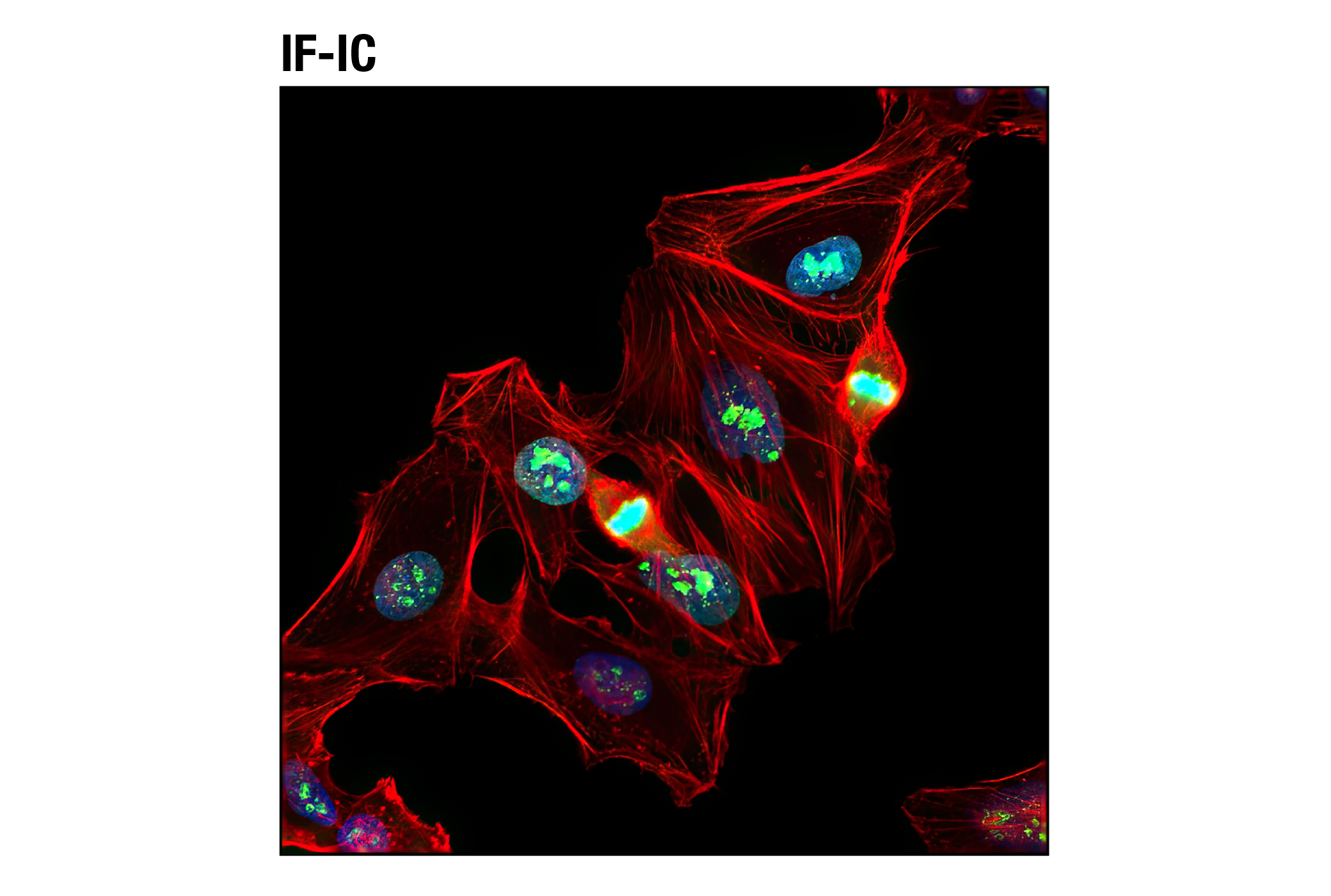 Immunofluorescence Image 2: Ki-67 (D3B5) Rabbit mAb (BSA and Azide Free)