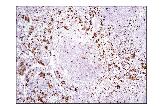 Immunohistochemistry Image 2: Ki-67 (D3B5) Rabbit mAb (BSA and Azide Free)