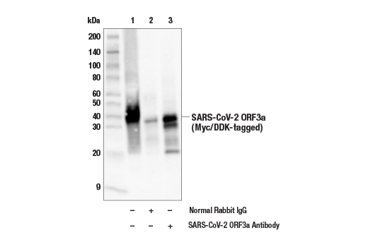 Immunoprecipitation Image 1: SARS-CoV-2 ORF3a Antibody