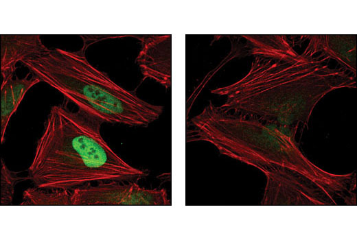  Image 12: Microglia Neurodegeneration Module Antibody Sampler Kit