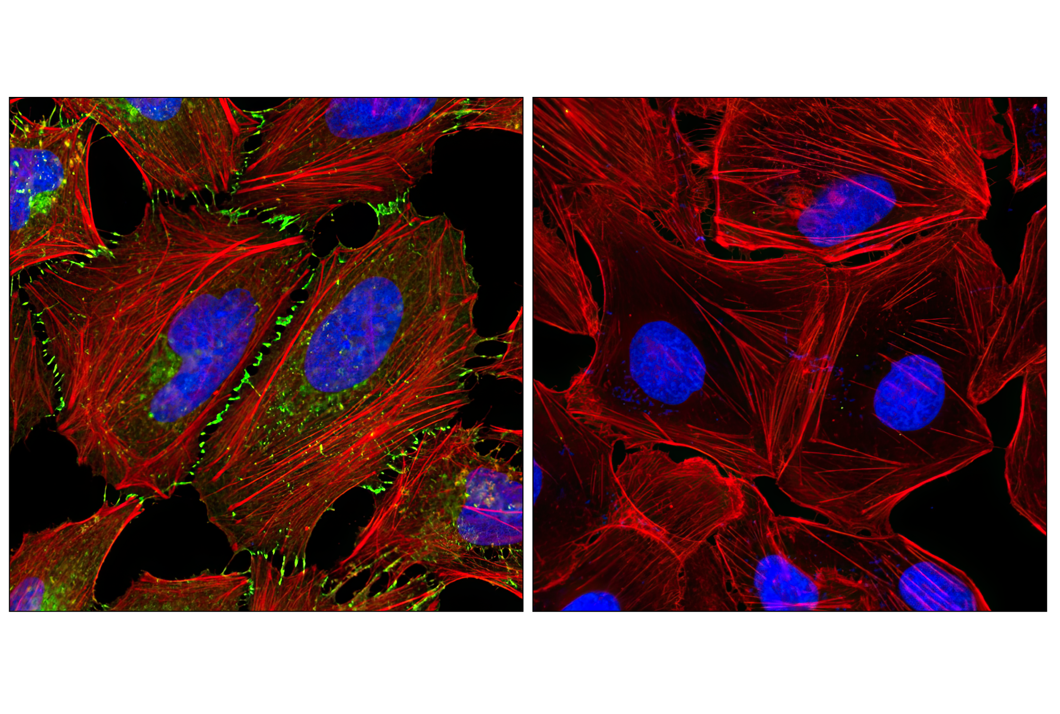 Immunofluorescence Image 1: β-Catenin (L54E2) Mouse mAb (BSA and Azide Free)