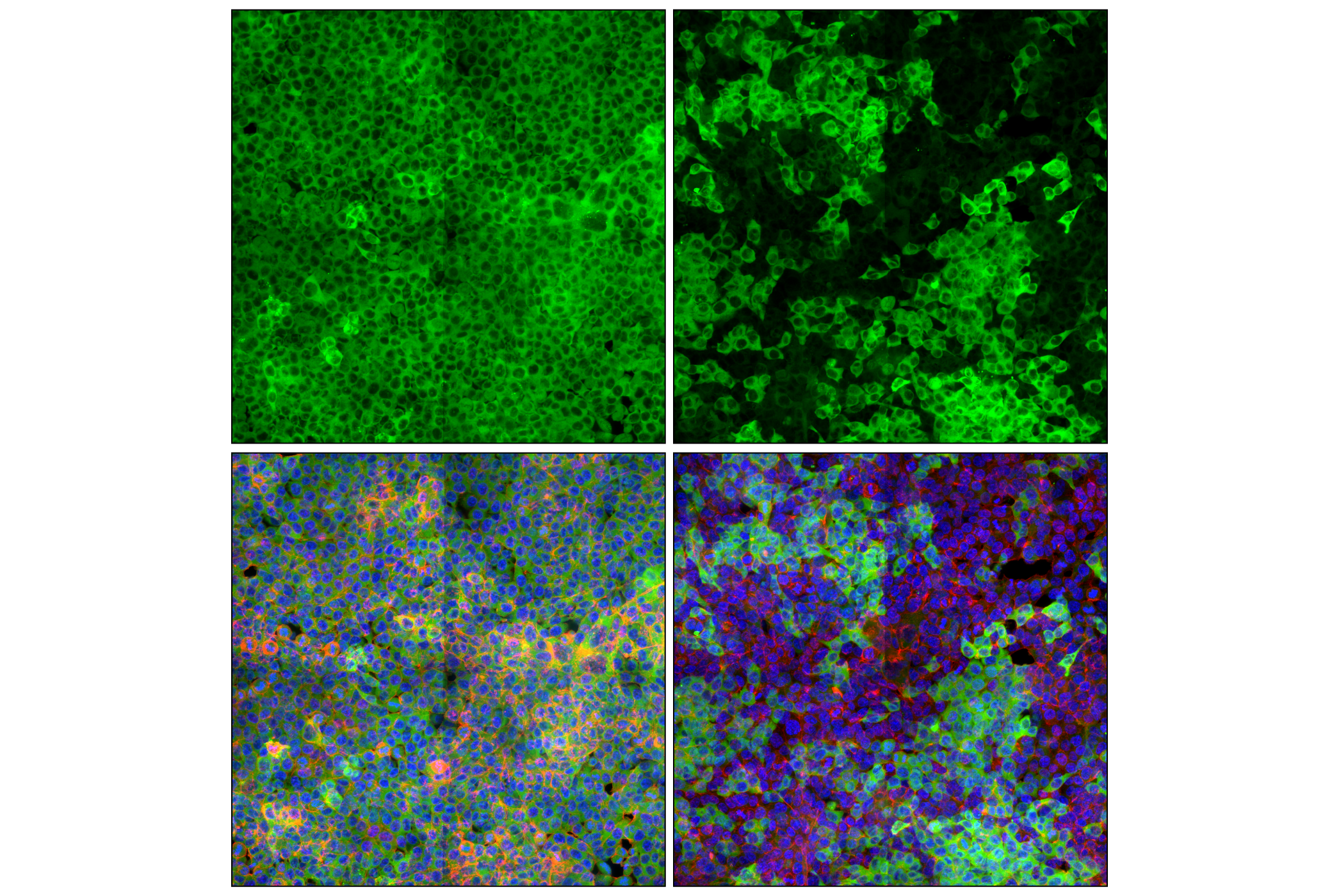 Immunofluorescence Image 1: PKM2 (D78A4) XP® Rabbit mAb (Alexa Fluor® 488 Conjugate)