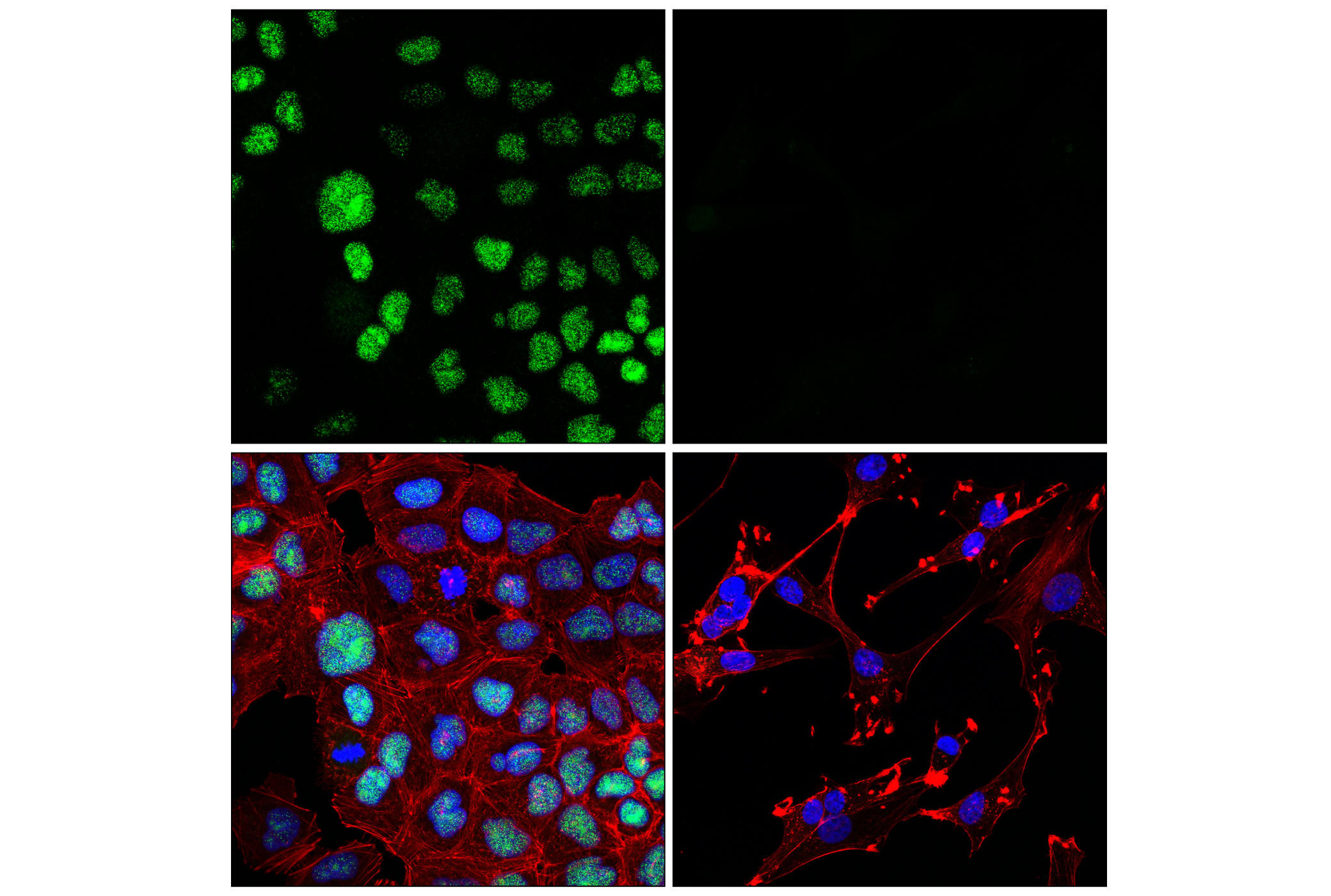 Immunofluorescence Image 1: NSUN5 (E5N7R) Rabbit mAb