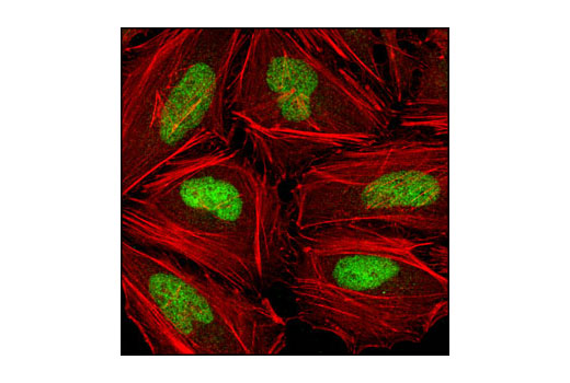 Immunofluorescence Image 1: Chk2 (1C12) Mouse mAb