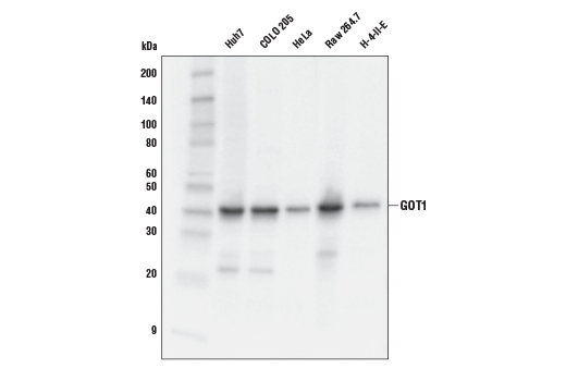  Image 3: Glutamine Metabolism Antibody Sampler Kit