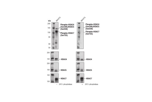  Image 1: Histone Deacetylase (HDAC) Antibody Sampler Kit