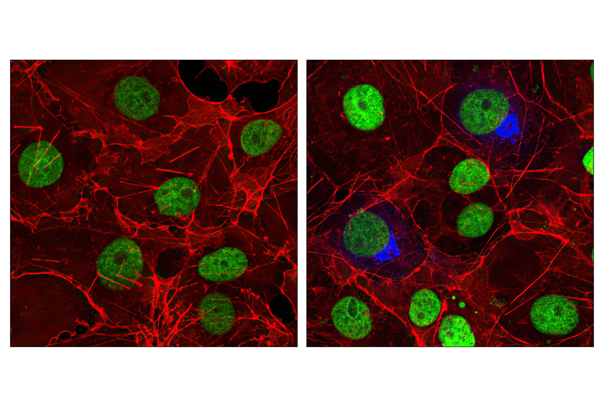 Immunofluorescence Image 1: HA-Tag (6E2) Mouse mAb (Alexa Fluor® 647 Conjugate)