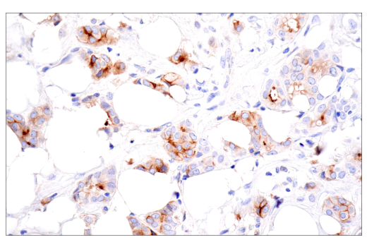 Immunohistochemistry Image 2: CD109 (E4I2V) Rabbit mAb (BSA and Azide Free)