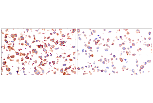 Immunohistochemistry Image 7: CD109 (E4I2V) Rabbit mAb (BSA and Azide Free)