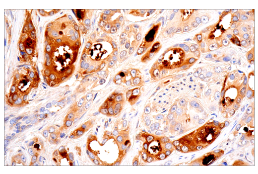 Immunohistochemistry Image 8: CD109 (E4I2V) Rabbit mAb (BSA and Azide Free)