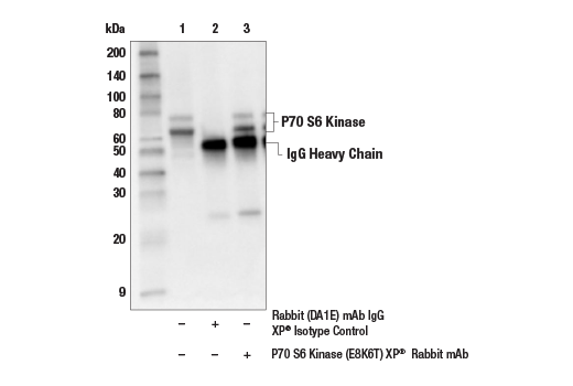 Immunoprecipitation Image 1: p70 S6 Kinase (E8K6T) XP® Rabbit mAb