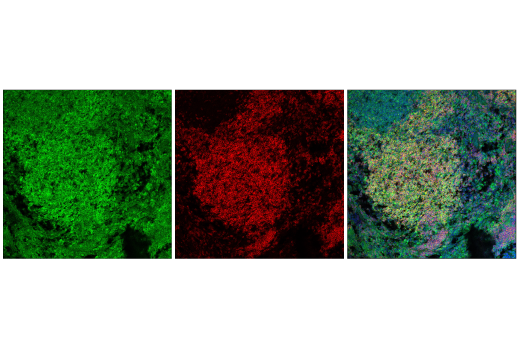 Immunofluorescence Image 1: p70 S6 Kinase (E8K6T) XP® Rabbit mAb