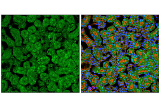Immunofluorescence Image 2: p70 S6 Kinase (E8K6T) XP® Rabbit mAb