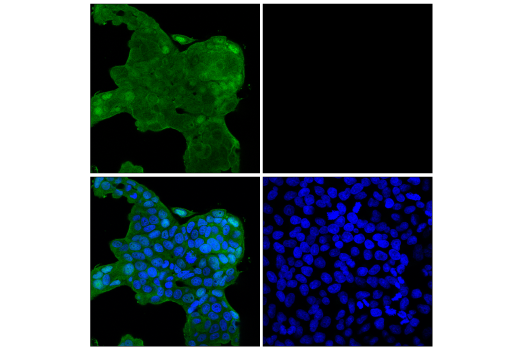 Immunofluorescence Image 3: p70 S6 Kinase (E8K6T) XP® Rabbit mAb