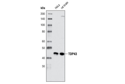 Western Blotting Image 1: TDP43 (G400) Antibody