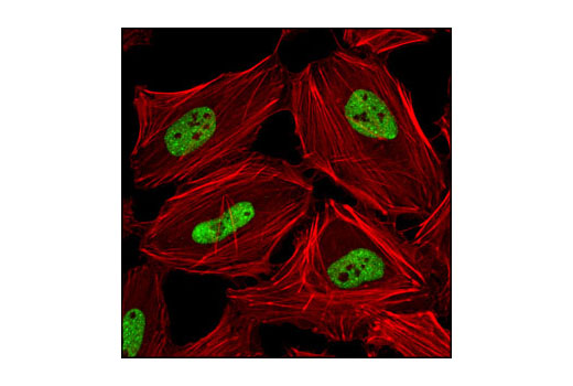 Immunofluorescence Image 1: TDP43 (G400) Antibody