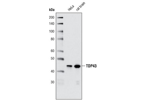 Western Blotting Image 1: TDP43 (A260) Antibody