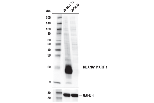 Western Blotting Image 1: MLANA/MART-1 Antibody
