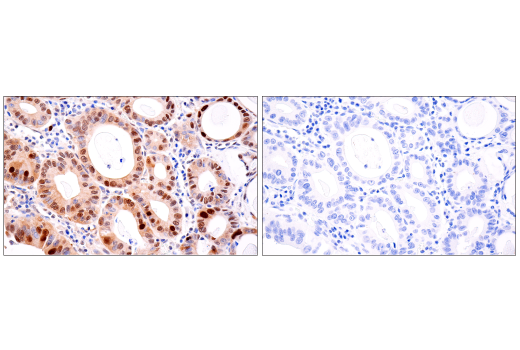 Immunohistochemistry Image 5: CDK2 (E8J9T) XP® Rabbit mAb (BSA and Azide Free)