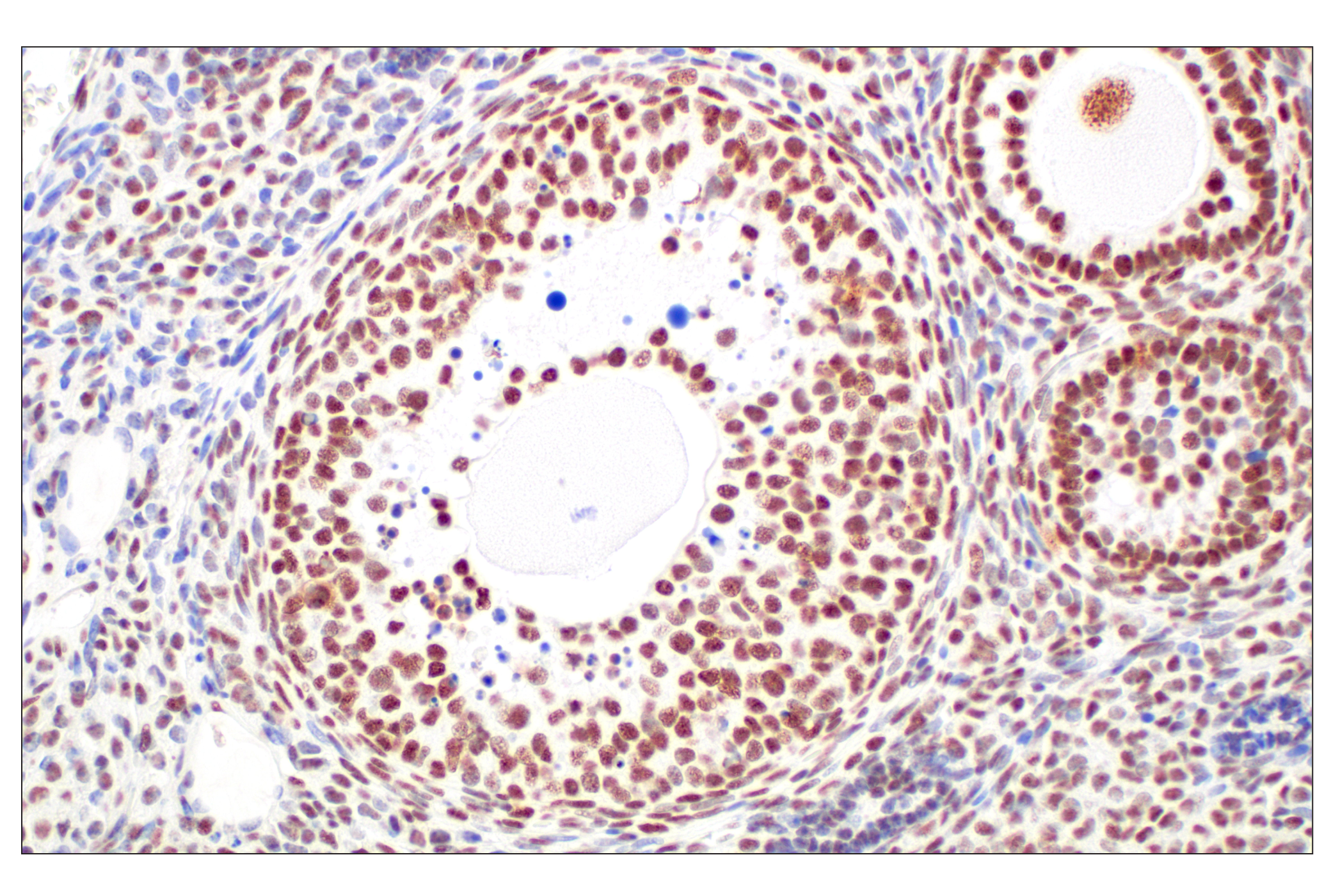 Immunohistochemistry Image 10: CBX7 (E7N1W) Rabbit mAb