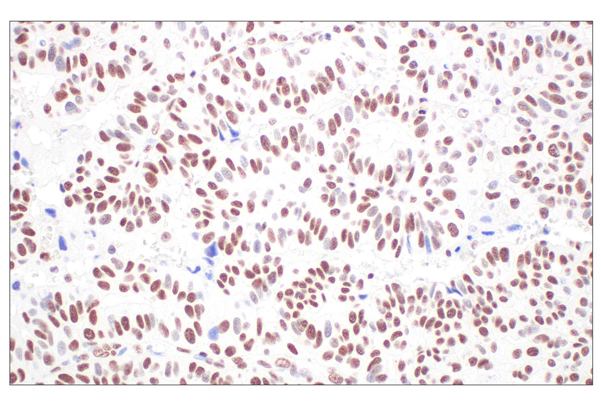 Immunohistochemistry Image 3: CBX7 (E7N1W) Rabbit mAb