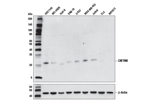 Western Blotting Image 1: CMTM6 Antibody