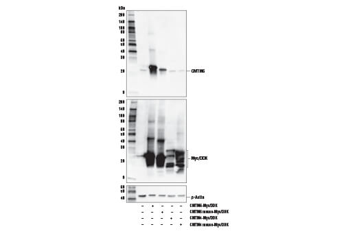 Western Blotting Image 2: CMTM6 Antibody