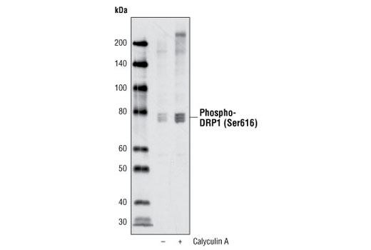Western Blotting Image 1: Phospho-DRP1 (Ser616) Antibody