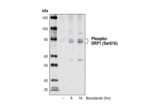 Western Blotting Image 2: Phospho-DRP1 (Ser616) Antibody