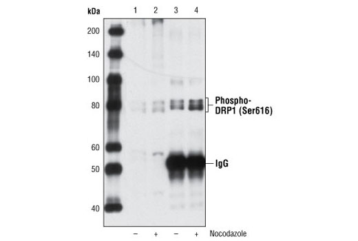 Immunoprecipitation Image 1: Phospho-DRP1 (Ser616) Antibody