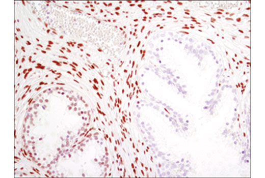 Immunohistochemistry Image 3: MeCP2 (D4F3) XP® Rabbit mAb