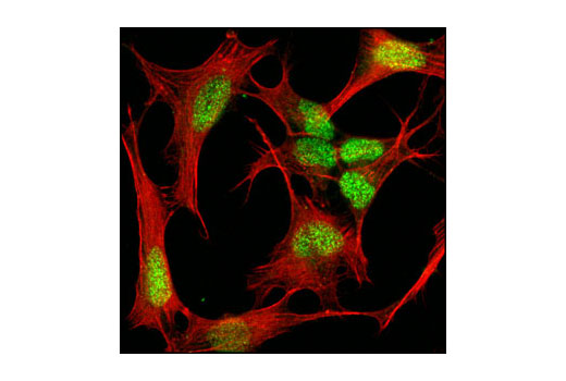 Immunofluorescence Image 2: MeCP2 (D4F3) XP® Rabbit mAb