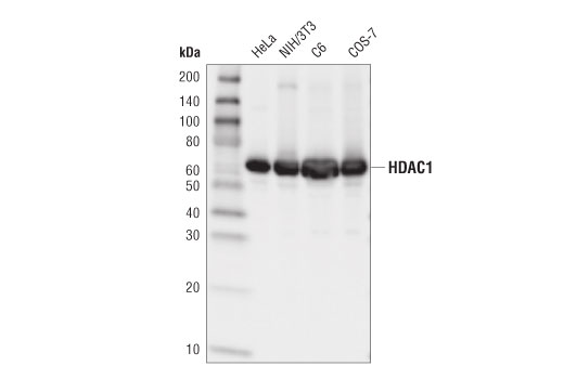  Image 1: Class I HDAC Antibody Sampler Kit
