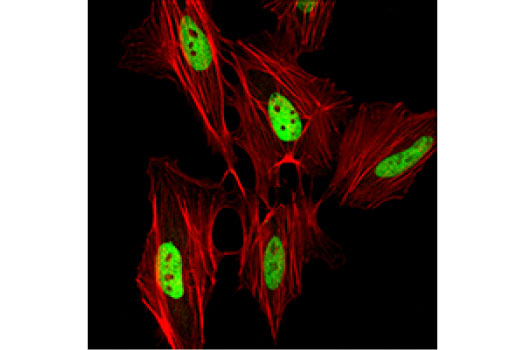 Immunofluorescence Image 1: HDAC1 (D5C6U) XP® Rabbit mAb