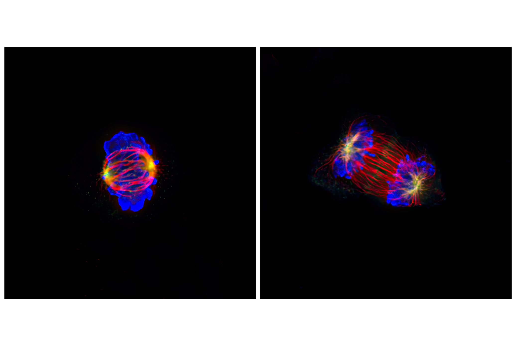 Immunofluorescence Image 1: Phospho-Histone H3 (Ser10) (D2C8) XP® Rabbit mAb (Alexa Fluor® 647 Conjugate)