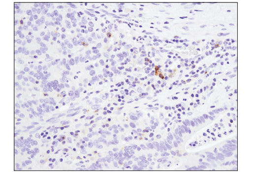 Immunohistochemistry Image 1: 4-1BB/CD137/TNFRSF9 (D2Z4Y) Rabbit mAb