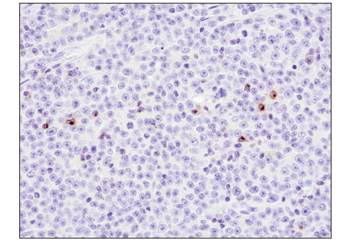 Immunohistochemistry Image 2: 4-1BB/CD137/TNFRSF9 (D2Z4Y) Rabbit mAb