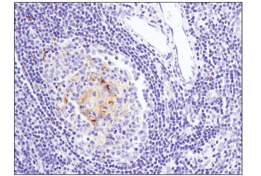 Immunohistochemistry Image 4: 4-1BB/CD137/TNFRSF9 (D2Z4Y) Rabbit mAb