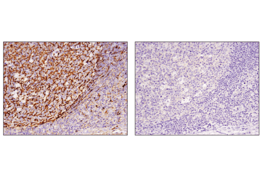 Immunohistochemistry Image 4: Clusterin (D7N2K) XP® Rabbit mAb