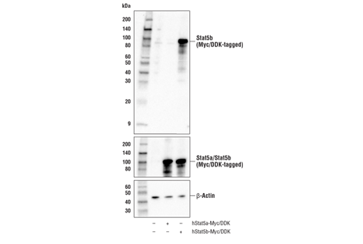 Western Blotting Image 1: Stat5b Antibody
