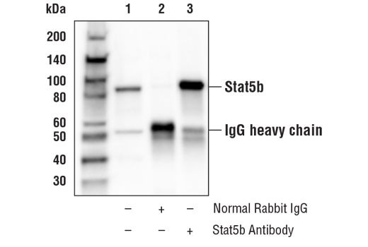 Immunoprecipitation Image 1: Stat5b Antibody