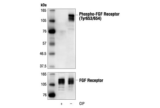 Western Blotting Image 1: Phospho-FGF Receptor (Tyr653/654) Antibody