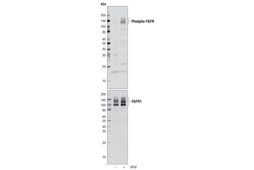 Western Blotting Image 2: Phospho-FGF Receptor (Tyr653/654) Antibody