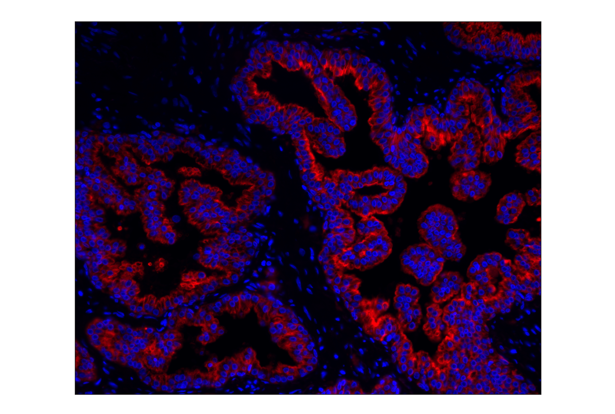 Immunohistochemistry Image 1: Pan-Keratin (C11) Mouse mAb (Alexa Fluor® 555 Conjugate)