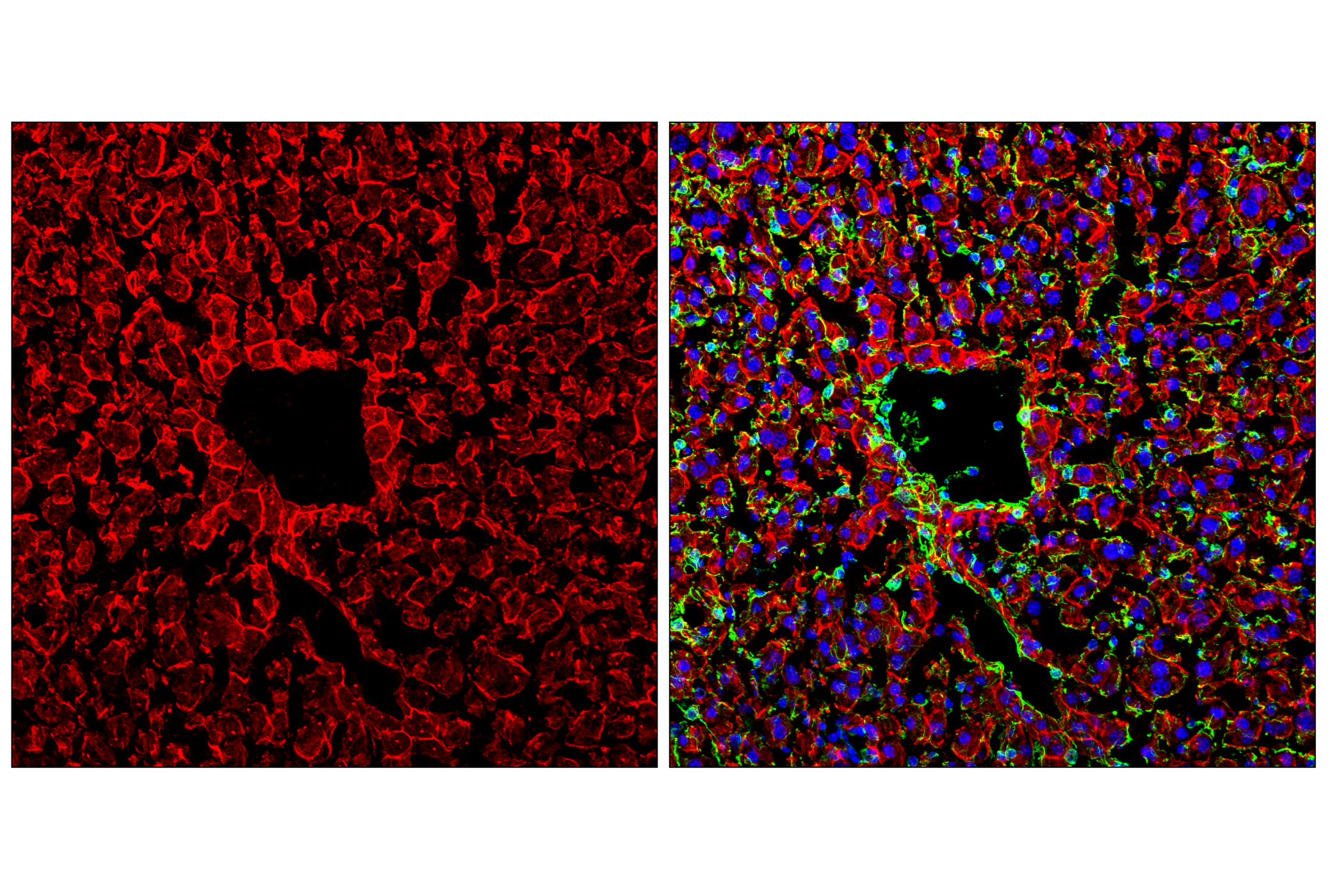 Immunofluorescence Image 1: Pan-Keratin (C11) Mouse mAb (Alexa Fluor® 555 Conjugate)