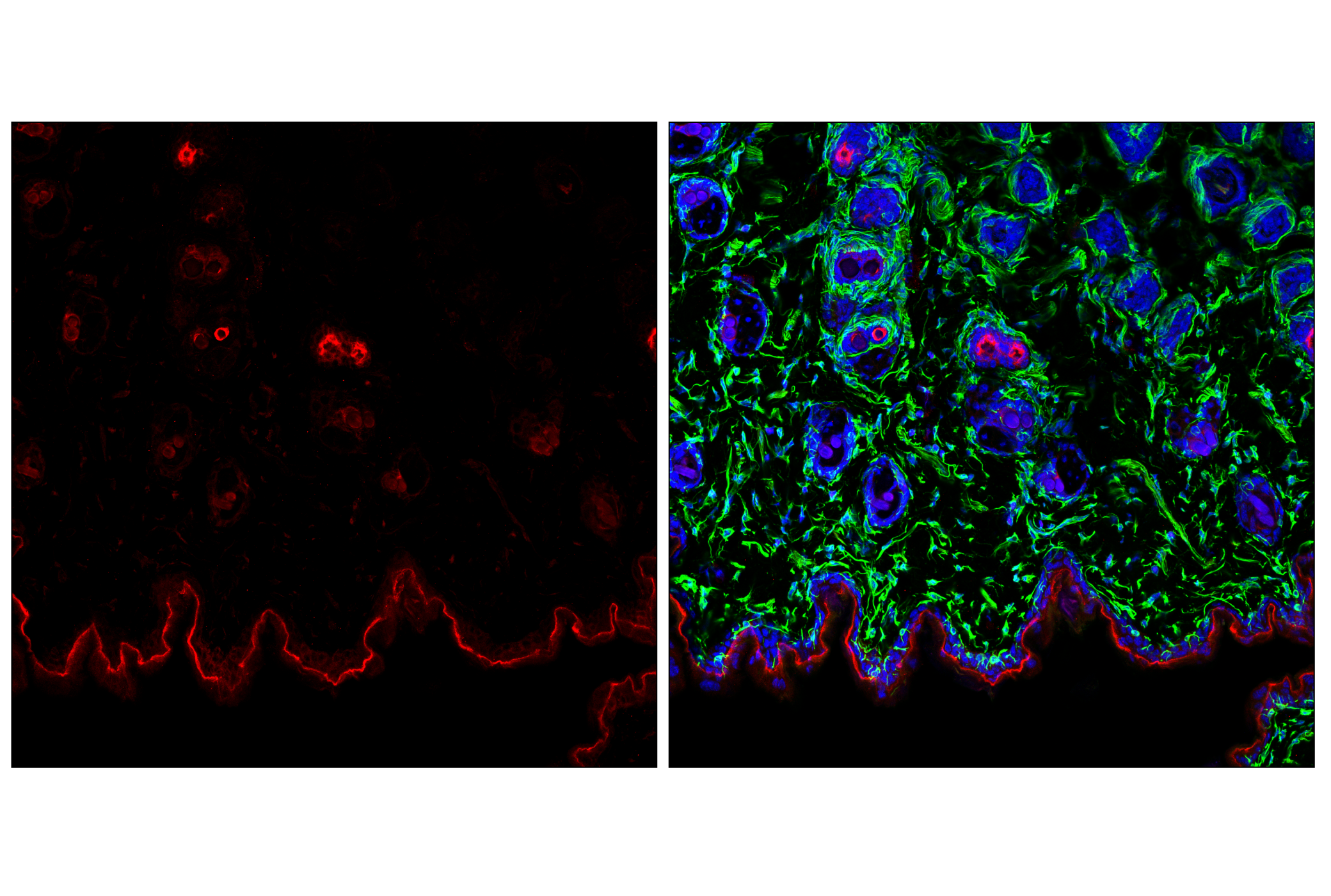 Immunofluorescence Image 2: Pan-Keratin (C11) Mouse mAb (Alexa Fluor® 555 Conjugate)