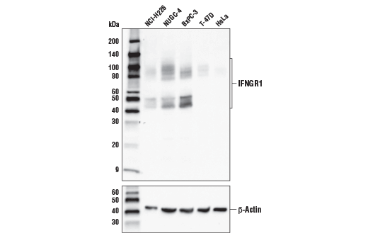 Western Blotting Image 1: IFNGR1 Antibody
